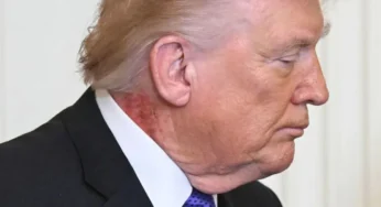 Trump’s Neck Rash Raises Health Speculations During Medal Ceremony
