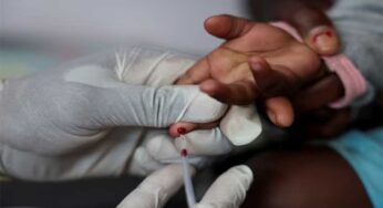Expert Resigns from US HIV Role, Rejects Trump’s Global Health Strategy