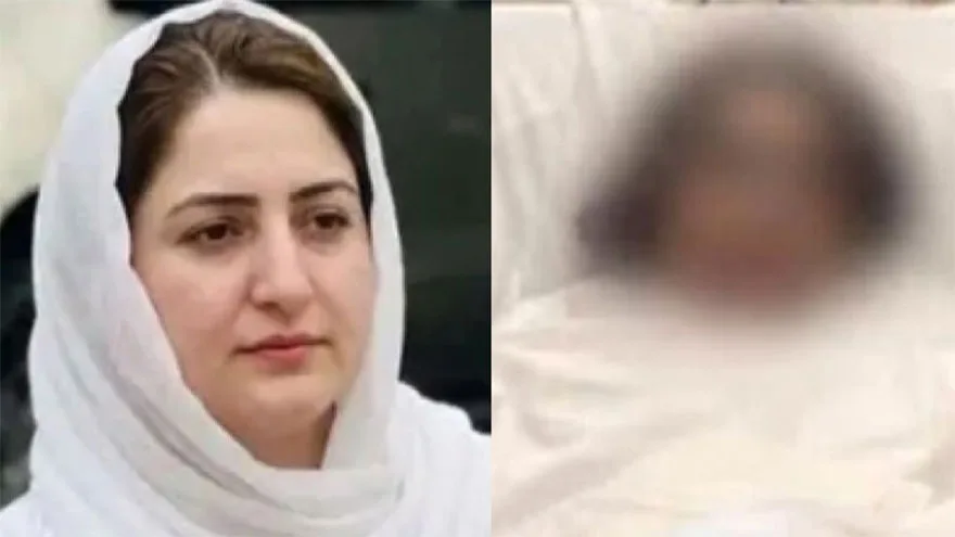 Acid Attack Victim Dr Mahnoor Undergoes Face Grafting Procedure in Quetta