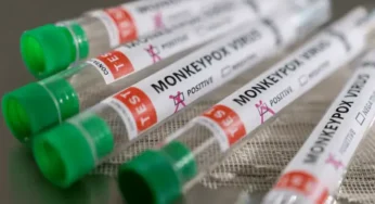 Karachi Reports Ninth Mpox Case as Local Transmission Fears Rise